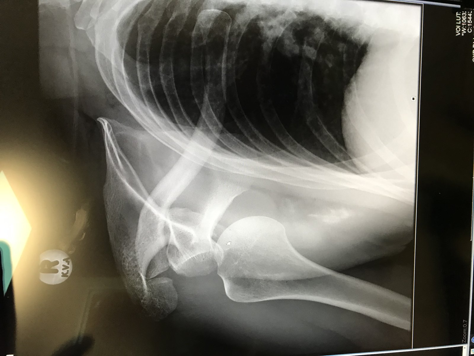 Windsurfing is fun.... but ....