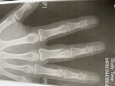 Windsurfing is fun.... but ....