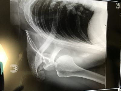 Windsurfing is fun.... but ....